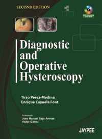 Diagnostic and Operative Hysteroscopy