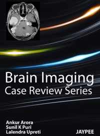 Brain Imaging