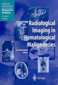 Radiological Imaging in Hematological Malignancies