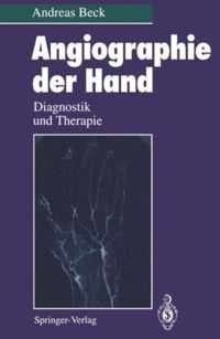 Angiographie Der Hand