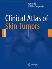 Clinical Atlas of Skin Tumors