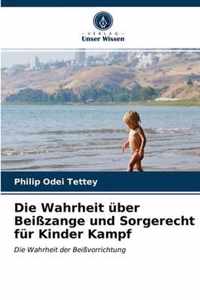 Die Wahrheit uber Beisszange und Sorgerecht fur Kinder Kampf