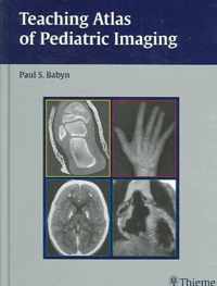 Teaching Atlas of Pediatric Imaging