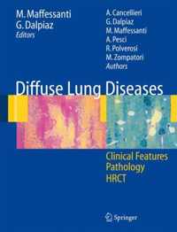 Diffuse Lung Diseases