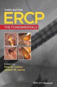 Ercp