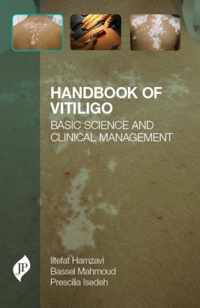 Handbook of Vitiligo