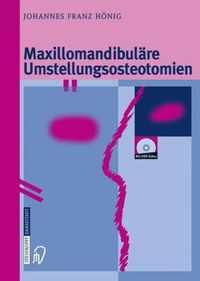 Maxillomandibul Re Umstellungsosteotomien