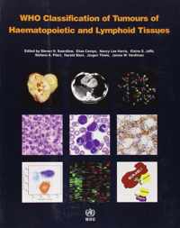 WHO classification of tumours of haematopoietic and lymphoid tissues: Vol. 2