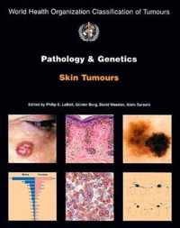 Pathology and genetics of skin tumours