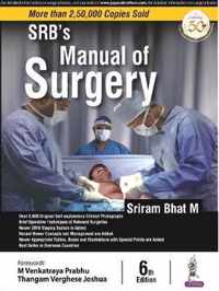 SRB's Manual of Surgery