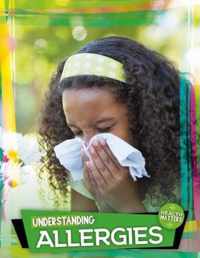 Understanding Allergies