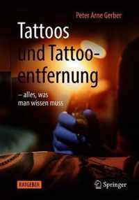 Tattoos und Tattooentfernung