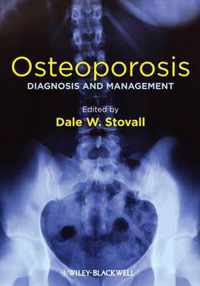 Osteoporosis