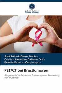 PET/CT bei Brusttumoren