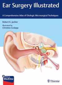 Ear Surgery Illustrated