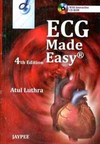 ECG Made Easy