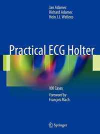 Practical ECG Holter