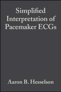 Simplified Interpretation of Pacemaker ECGs