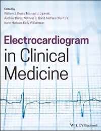 Electrocardiogram in Clinical Medicine