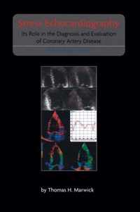 Stress Echocardiography