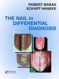 Nail in Differential Diagnosis