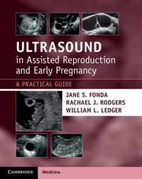 Ultrasound in Assisted Reproduction and Early Pregnancy