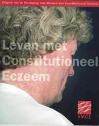 Leven met constitutioneel eczeem