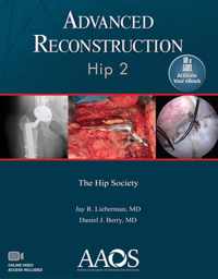 Advanced Reconstruction: Hip 2