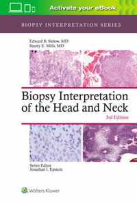 BIOPSY INTERPRETATION HEAD NECK 3E CB