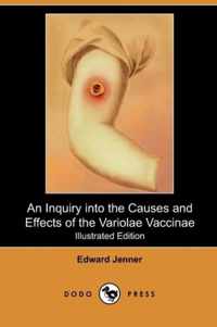 An Inquiry Into the Causes and Effects of the Variolae Vaccinae