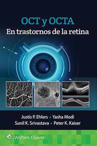 OCT y OCTA en trastornos de la retina