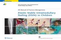 Elastic Stable Intramedullary Nailing (ESIN) in Children