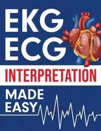 EKG ECG Interpretation Made Easy