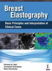 Breast Elastography