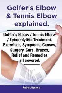 Golfer's Elbow & Tennis Elbow explained. Golfer's Elbow / Tennis Elbow / Epicondylitis Treatment, Exercises, Symptoms, Causes, Surgery, Cure, Braces, Relief and Remedies all covered.