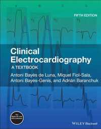 Clinical Electrocardiography - A Textbook 5e