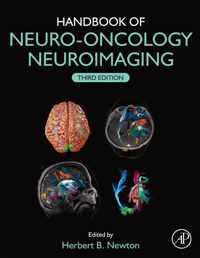 Handbook of Neuro-Oncology Neuroimaging