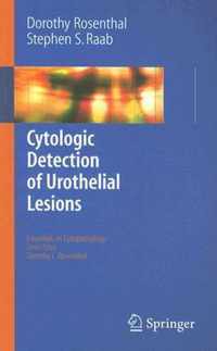 Cytologic Detection of Urothelial Lesions