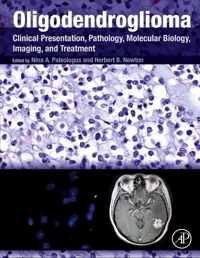 Oligodendroglioma