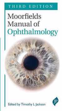 Moorfields Manual of Ophthalmology