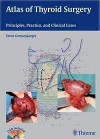 Atlas of Thyroid Surgery