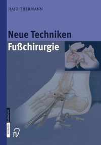 Neue Techniken Fusschirurgie