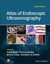 Atlas of Endoscopic Ultrasonography 2e