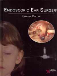 Endoscopic Ear Surgery