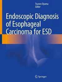 Endoscopic Diagnosis of Esophageal Carcinoma for ESD