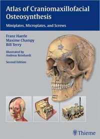 Atlas of Craniomaxillofacial Osteosynthesis