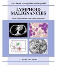 Lymphoid Malignancies