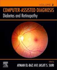 Diabetes and Retinopathy