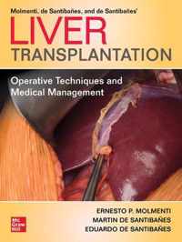 Liver Transplantation