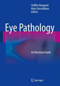 Eye Pathology